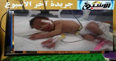 متابعة سيد زعزوع الأمم المتحدة تحذر من الأوضاع شمال غزة: توقف آخر وحدة للعناية المركزة لحديثي الولادة حذر صندوق الأمم المتحدة للسكان من تصاعد أزمة الصحة الإنجابية في شمال قطاع غزة.