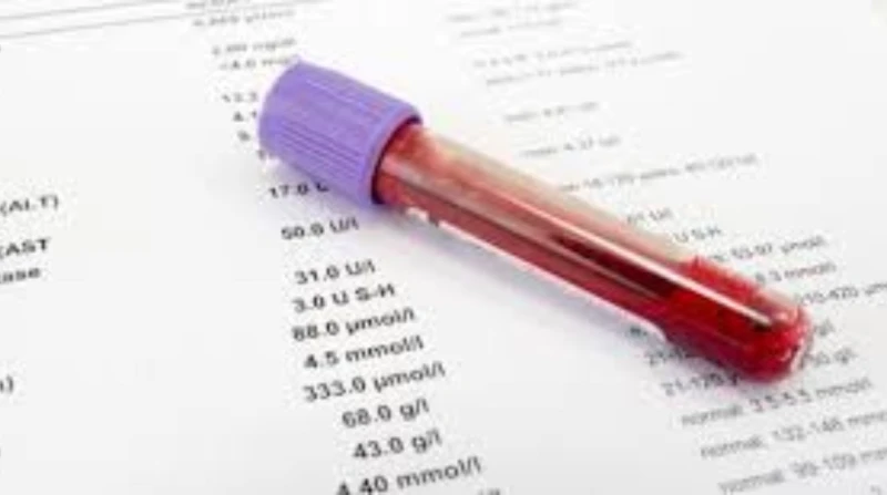 5 أضرار.. نقابة الصحفيين تكشف أسباب إيقاف التعامل مع معامل كبري علقت نقابة الصحفيين على قرار إيقاف التعامل مع مجموعات معامل المختبر والبرج وألفا،