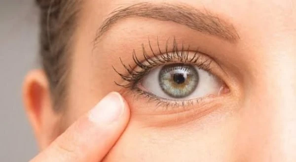 أفضل العلاجات المنزلية لعلاج لجفاف العين.هناك العديد من العوامل المختلفة التي يمكن أن تمنع الغشاء الدمعي من العمل كما ينبغي وتؤدي إلى جفاف العين.إذا كنت تعاني من جفاف العين، فمن ال