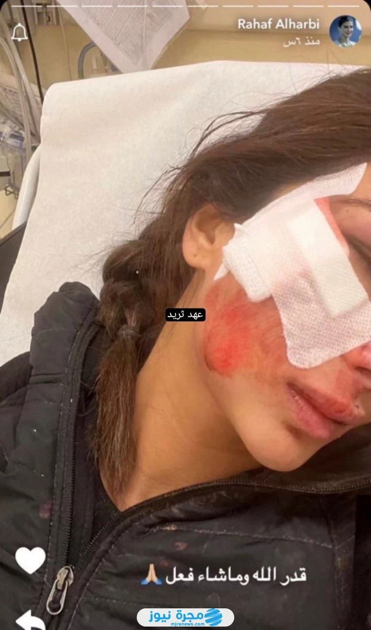 شاهد حصريا.. صور المودل رهف الحربي 2024 صور رهف الحربي، عارضة الأزياء السعودية التي أصبحت حديث الساعة على منصة التويتر والسناب شات، وذلك بعد تعرضها لحادث أليم وانتشار صور لوجهها وه