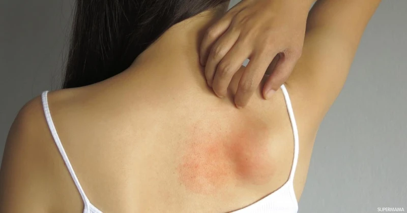 استشاري أمراض الحساسية والمناعة يكشف عن انتشار 4 فيروسات في موسم الشتاء كتبت أميرة السمانكشف الدكتور أمجد الحداد، استشاري أمراض الحساسية والمناعة، عن تأثير التناول المتكرر لعقار ال