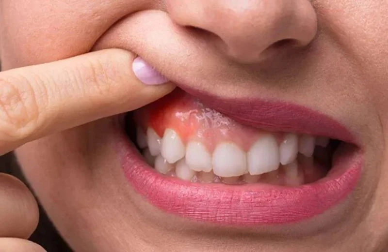 أعراض خطيرة للسرطان تلاحظ عند تنظيف الأسنان أعراض خطيرة للسرطان تلاحظ عند تنظيف الأسنان صوت المسيحي الحر أعراض خطيرة للسرطان حذر خبراء الصحة من أعراض