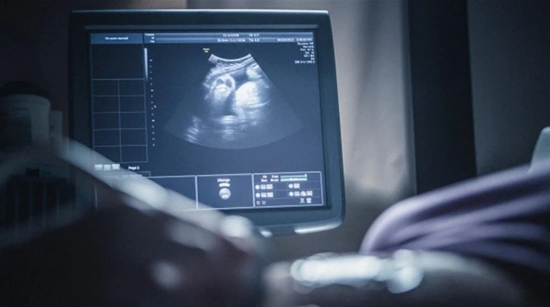 علماء: الأجنة تتحكم في الأمهات بالريموت كشف فريق من العلماء في جامعة كامبريدج عن آلية مذهلة تتيح للأجنة التحكم في العناصر الغذائية التي تحصل عليها من الأم أثناء الحمل، وذلك من خلال