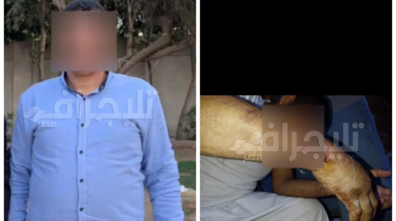 خايف منهم.. أب يتهم أبناءه الثلاثة بالاعتداء عليه بالشوم كسروا لي دراعي وركبت شرايح ومسامير.. عبارة صادمة قالها أب مكلوم يدعى أحمد البدوي، إذ اتهم أبناءه الثلاثة بالتعدي عليه بالضر