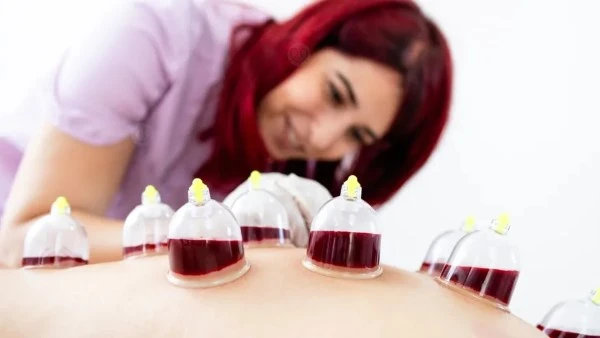 تعرف على فوائد الحجامة للنساء أفاق عربية أصبح العلاج بالحجامة أحد الأساليب العلاجية المنتشرة بشكل ملحوظ في السنوات الأخيرة، حيث يعتمد على سحب الدم الفاسد والسموم من الجسم لتحفيز ال