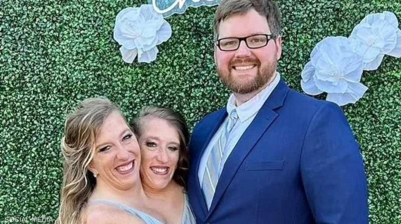 آبي وبريتاني هنسل.. حقيقة حمل التوأم الملتصق الأشهر في العالم تصدر التوأم الملتصق الأشهر عالميا، آبي وبريتاني هنسل، عناوين الأخبار العالمية بعد انتشار شائعات عن حمل إحدى الشقيقتين،