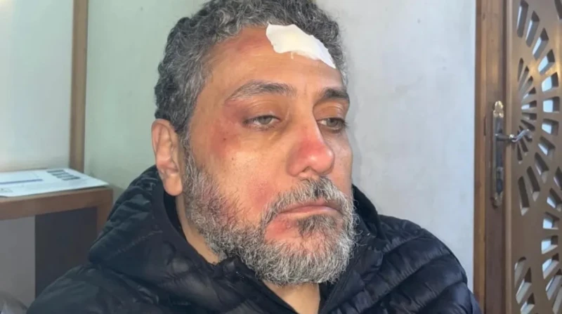 إصابة في الرأس.. تفاصيل الحالة الصحية ل تامر فرج أعلنت رانيا هشام، زوجة الفنان تامر فرج عن تعرضه لحادث أثناء تصويره مسلسله الجديد الذي يشارك به في