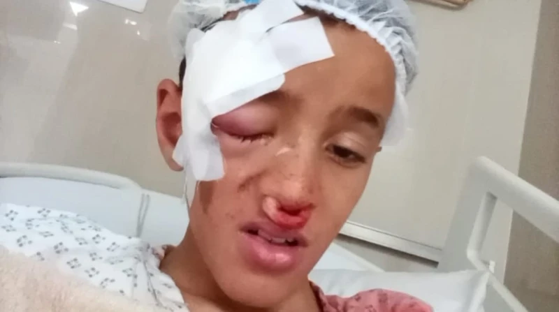 اخترق الجمجمة.. طفل يفقأ عين آخر معلش القلم اخترق الجمجمة.. بدأت السيدة فاتن استغاثتها بهذه العبارة، بعد أن تعرض ابنها آدم هشام، البالغ من العمر 10 سنوات، لواقعة مؤسفة على يد زميله