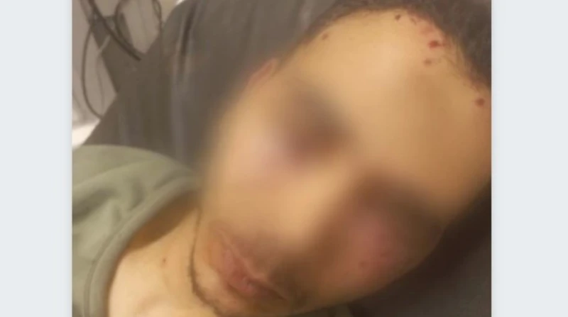 رصاصة طائشة تفقد عاملا بصره في شبرا الخيمة تحولت طلقات خرطوش طائشة إلى كابوس حقيقي لعامل شاب في منطقة شبرا الخيمة بمحافظة القليوبية، بعدما أفقدته