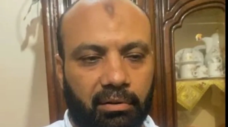 استئصال طحال وتنفس صناعي.. آخر تطورات الحالة الصحية للناجيات من حادث الإقليمي (فيديو) كشف أحمد أبو شنب طبيب حبيبة الناجية من حادث الطريق الإقليمي بالمنوفية، والذى أسفر عن وفاة 18 ف