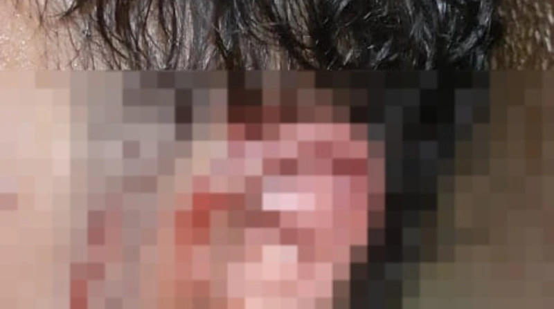 فرخة يعتدي على محام أثناء تأدية عمله في الإسكندرية.. صور شهدت منطقة باكوس بمحافظة الإسكندرية واقعة اعتداء عنيف، تعرض خلالها المحامي رشاد حسني وشقيقه أحمد حسني، مدير الشؤون القانوني