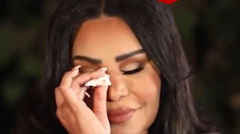 ماذا حدث بعد 3 أشهر من تجميل أنف أحلام؟