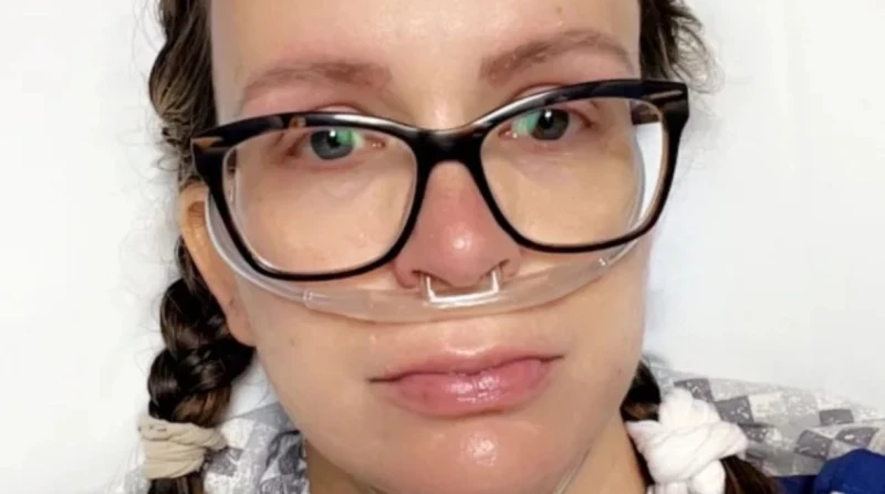 ولادة طبيعية تكشف إصابة أم بسرطان دم خطير دون أعراض سابقة