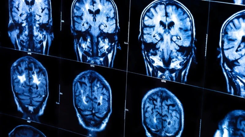 دراسة جديدة توضح لماذا تعمل أدمغة الذكور بشكل مختلف بيولوجيًا عن الإناث؟