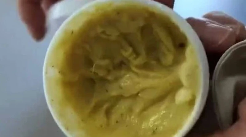 تشبه الثعابين، خطوط غامضة على جلد امرأة بعد استخدام كريم عبر الإنترنت