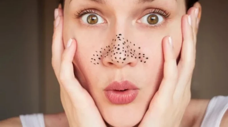 من قلب مطبخك، تخلصي من الرؤوس السوداء بأسهل الطرق