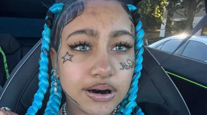 بعد ترند ابنة كيم كارداشيان، إكسسوارات الأسنان خطر يهدد المراهقات