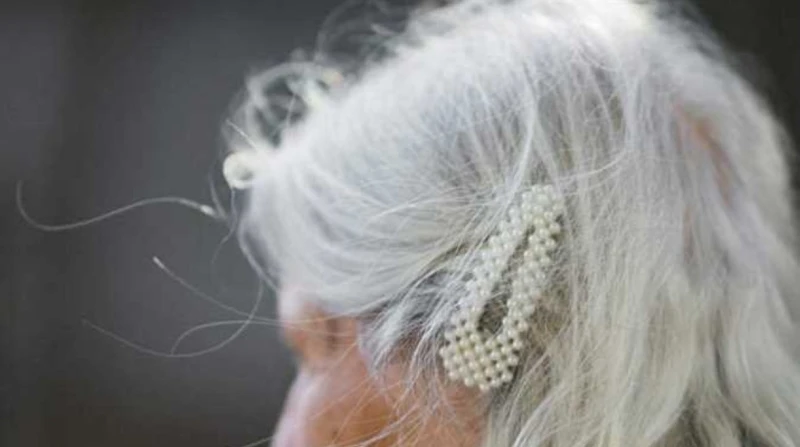 بين فضول النساء وتحذير الأطباء، حقن الشعر الرمادي هل تخفي آثار الشيب؟