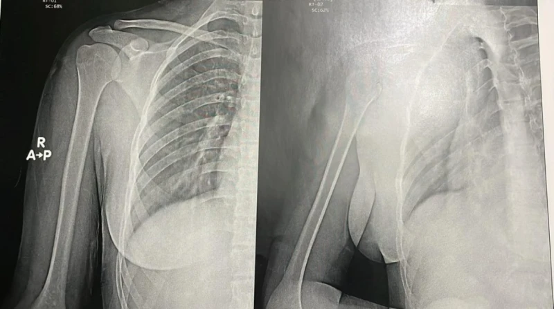 طمع مالي بمستشفى خاص في أكتوبر، أجروا فحوصات غير مبررة لفتاة بـ6 آلاف جنيه