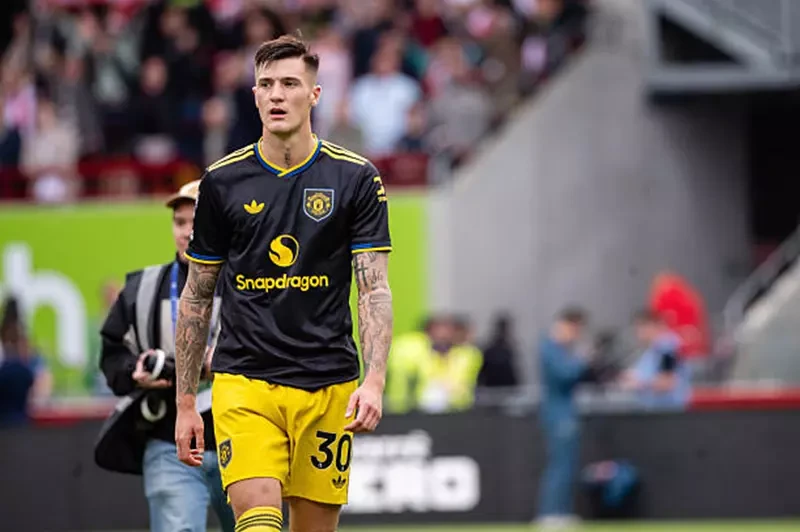 اليونايتد يفقد بنجامين سيسكو شهراً بسبب الإصابة