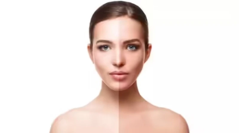 عسل وصبار, وصفات طبيعية لتفتيح البشرة وإزالة البقع الداكنة