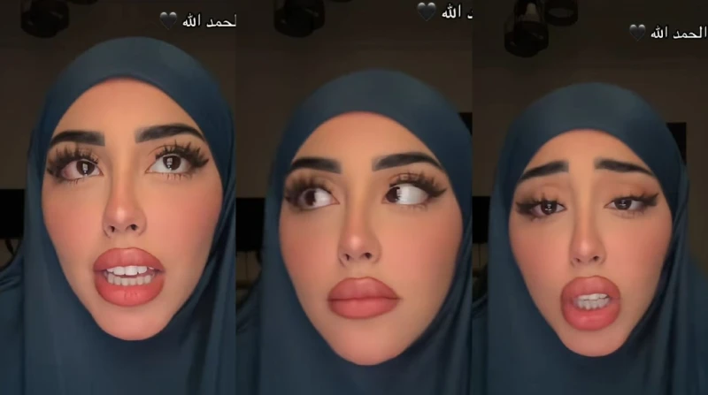 متلازمة الجنين الضفدع، حالة طبية أفشت الرعب في قلوب الحوامل