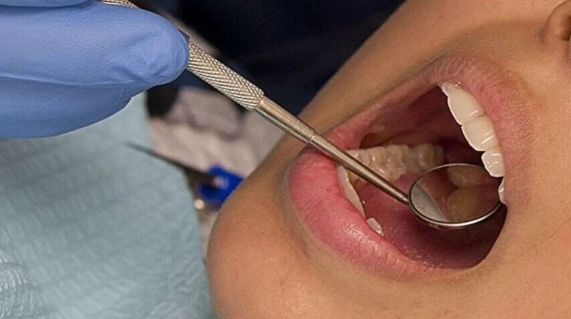 دراسة أمريكية: التهاب اللثة يزيد من خطر الإصابة بأمراض القلب