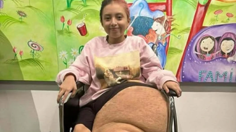 تبرعت عائلتها بساقها المبتور، حقيقة قصة الطفلة ياسمين