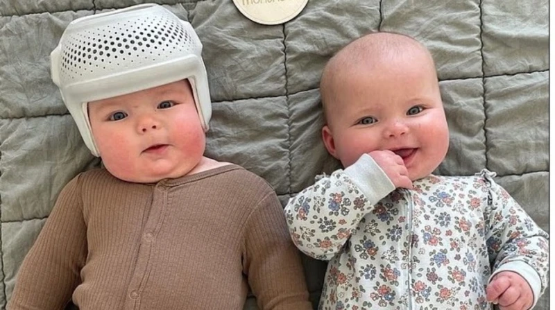 23 ساعة يوميًا.. قصة الأم التي أعادت تشكيل رؤوس طفليها التوأم