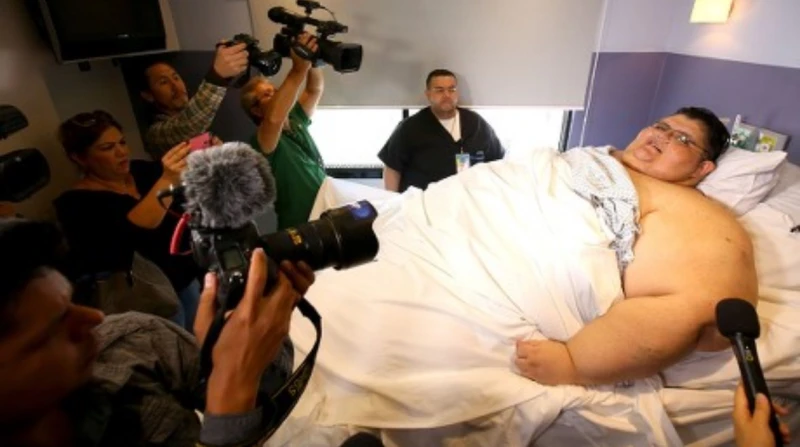 عدوى خطيرة، وفاة الرجل الأكثر بدانة في العالم