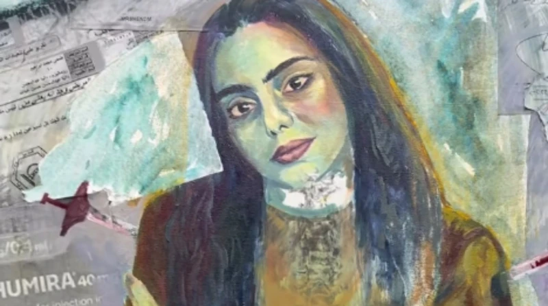 طالبة فنون جميلة تحكي رحلتها مع "التيبس الفقاري" وتحويله إلى لوحة فنية