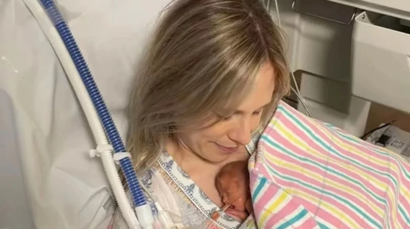 129 يومًا بالعناية المركزة ، توأم يخرج من أخطر عملية ولادة بأستراليا