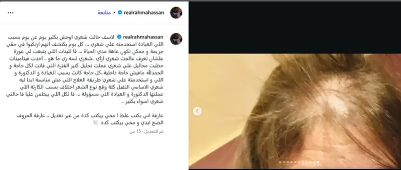رحمة حسن تكشف تفاصيل خطأ طبي أفقدها شعرها