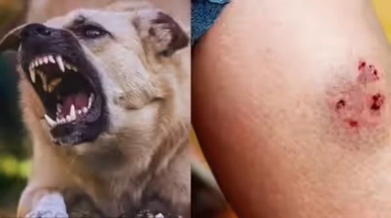 بعد وفاة شاب بالدقهلية، 6 إسعافات أولية تجنبك خطر "عضة الكلب"