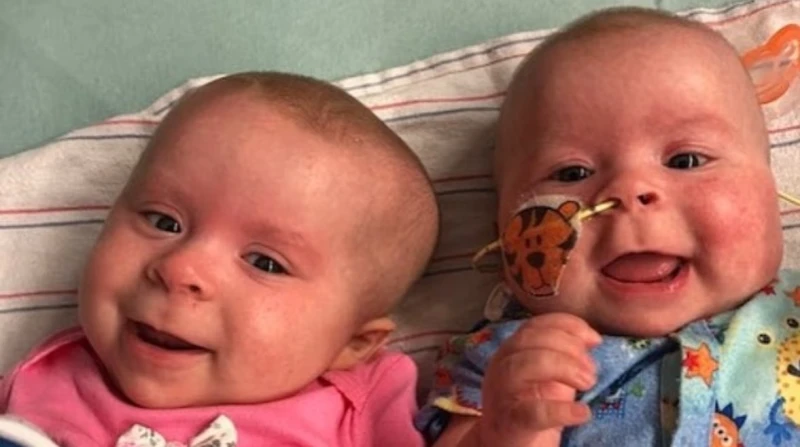 سيدة تكتشف إصابة توأمها بالسرطان بعد رؤية صورة لهما