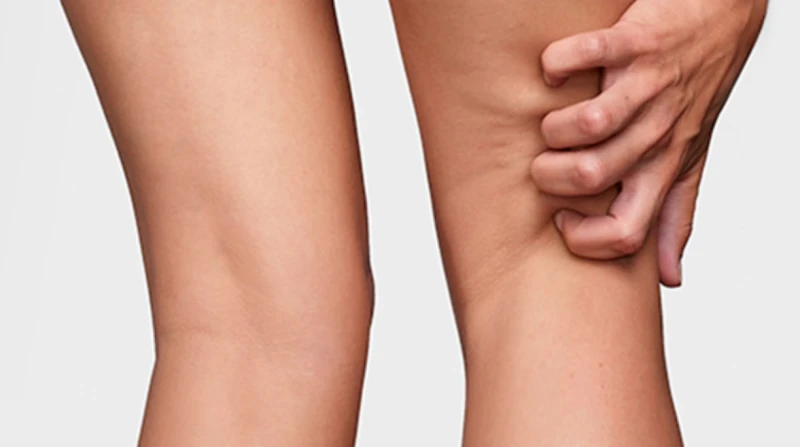 "حكة وتنميل الساقين".. أعراض بسيطة قد تحمل تحذيرًا صحيًا كبيرًا