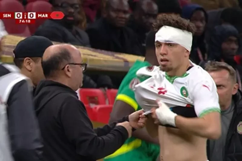 ست دقايق قلق.. إصابة العيناوي توقف نهائي أمم أفريقيا