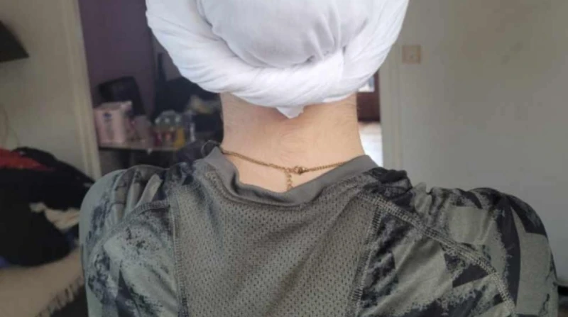 مدرسة فرنسية تفصل طالبة مريضة بالثعلبة لارتدائها قبعة "تشبه الحجاب"