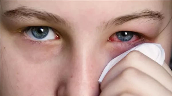 تحذير من الهاتف المحمول للكبار والصغار يسبب 5 أمراض للعين