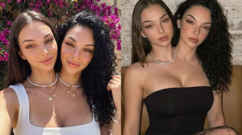 توأم ملتصق يكسب قلوب المستخدمين.. والحقيقة صادمة