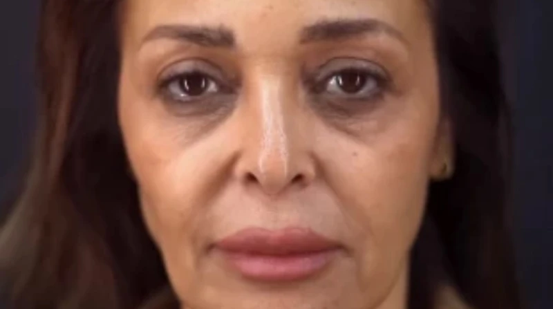 لسه صغيرة. داليا البحيري تكشف تفاصيل خضوعها لعملية شد الوجه والرقبة