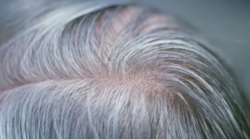 ليست مجرد علامة للسن. لماذا يعتبر ظهور الشيب خبرا سارا لصحتك وجهازك المناعي