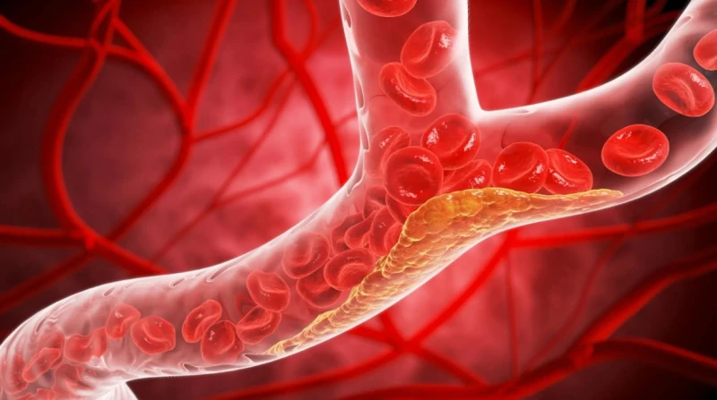 حبوب تخفّض الكوليسترول 60%. هل تغير قواعد الوقاية من أمراض القلب