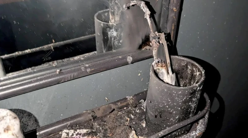 امرأة تنجو من الموت بعد انفجار فرشاة أسنانها الكهربائية