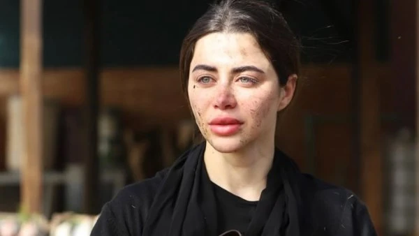 يارا السكري: نفسي أعيش قصة حب زي روح في مسلسل علي كلاي