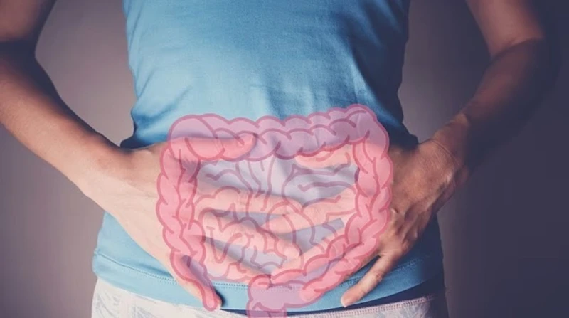 دراسة: سرطان الأمعاء يتصدر قائمة مسببات الوفاة قبل سن الـ50