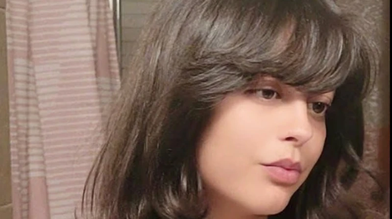 كانت تحمي ابنها. نهاية غير متوقعة لأم داعبت ثلاثة كلاب