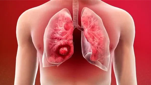 100 مليون صحة.. اطمئن على صحتك قبل فوات الأوان واحم نفسك من السرطان