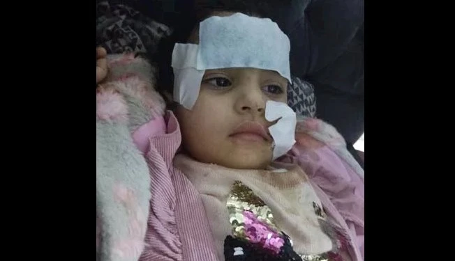 طفلة ٣ سنوات أبوها أخدها يصورها مع الأسد فمزقها