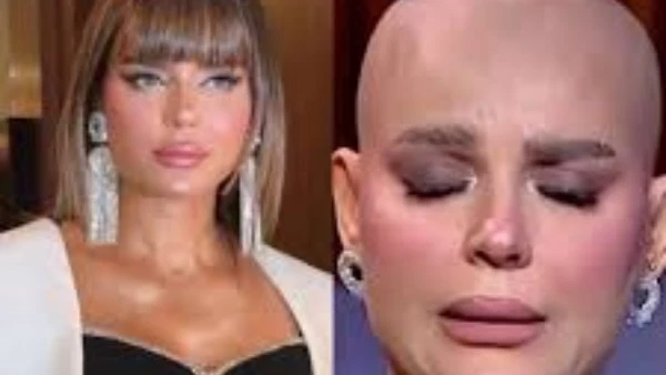 هبة السيسي: شكلي اتغير وشعري وقع ومبقتش قادرة أمارس حياتي بشكل طبيعي